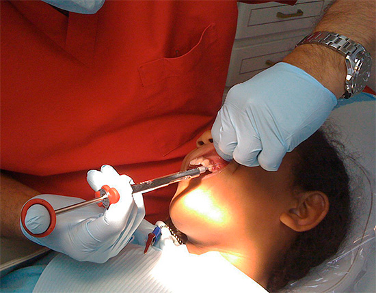 C'est ainsi que l'anesthésie locale est réalisée en dentisterie