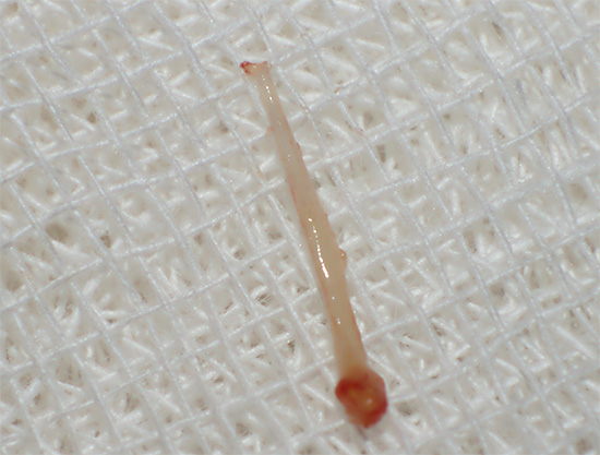 Photo de pulpe extraite d'une dent