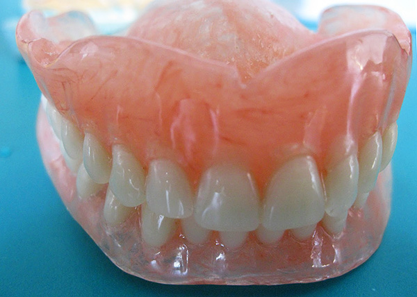 Prothèses dentaires entièrement amovibles en nylon (sur les mâchoires supérieure et inférieure).