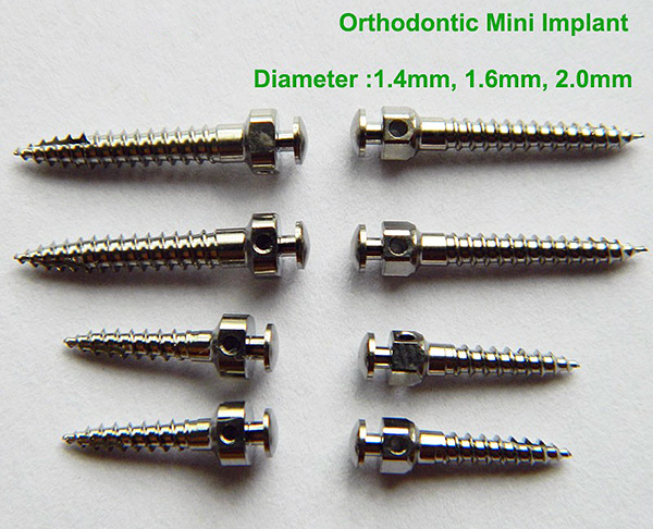Mini implants