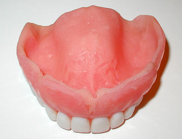 Pour une fixation fiable dans la bouche, la base de la prothèse doit être bien ajustée contre le palais.